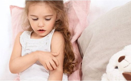 Dermatite Atopica nei bambini